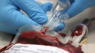 Jehovah's witness blood transfusion