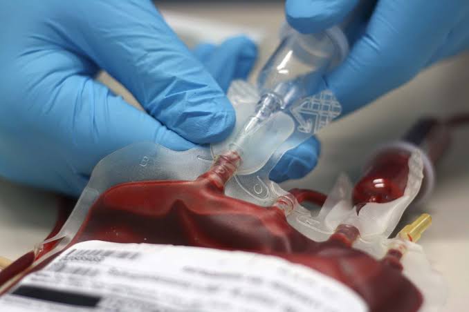 Jehovah's witness blood transfusion