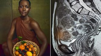 Kenyan Actress Lupita Nyong’o Launches Campaign to End Silence on Fibroids