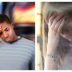 Why Some People Faint While Urinating at Night: Understanding Micturition Syncope
