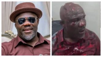 Delta Government Protocol Officer Allegedly Beaten in Warri After Chaos at APC Meeting