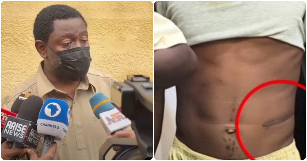 Police Arrest Four Doctors, Others Over Alleged Kidney Trafficking in Nasarawa and Abuja