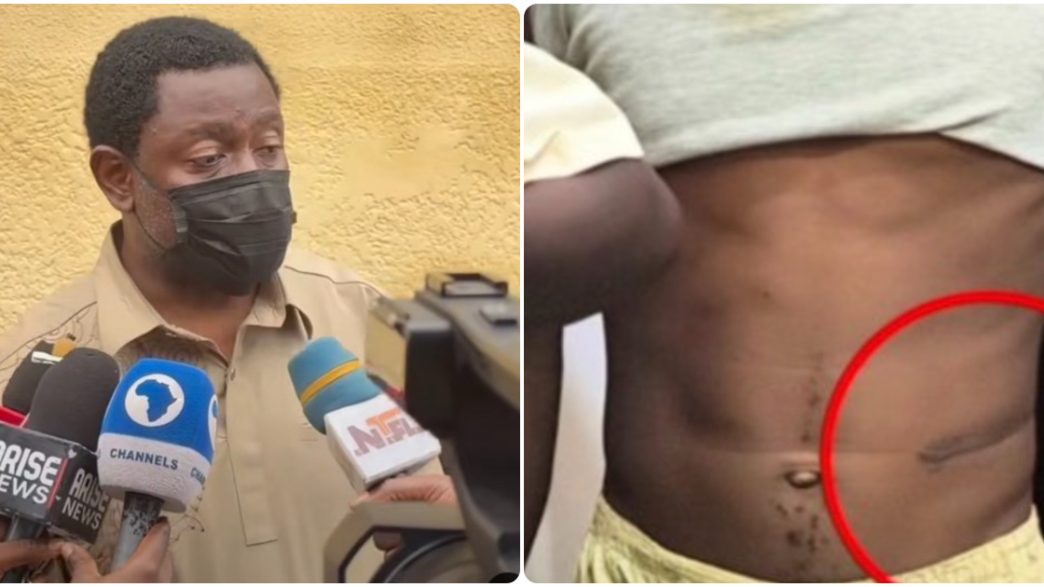 Police Arrest Four Doctors, Others Over Alleged Kidney Trafficking in Nasarawa and Abuja