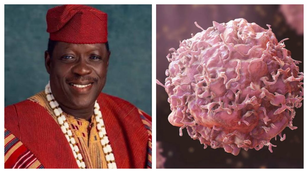 Cancer Is Not Always Unavoidable: What Raises the Risk and What You Can Actually Prevent