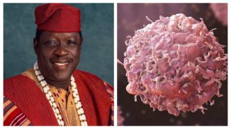 Cancer Is Not Always Unavoidable: What Raises the Risk and What You Can Actually Prevent