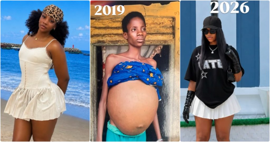 Patrick Efezino shares her transformation photos