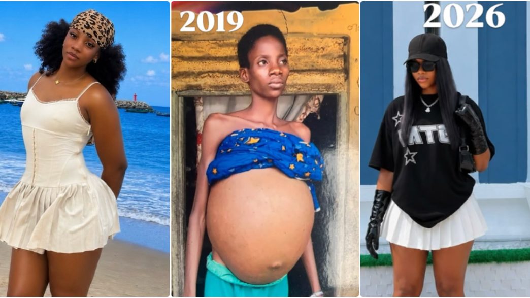 Patrick Efezino shares her transformation photos