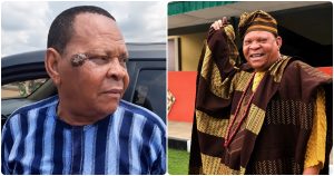 Actor Adewale Elesho Breaks Silence on Cancer Rumours Over Facial Sore