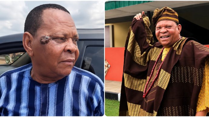 Actor Adewale Elesho Breaks Silence on Cancer Rumours Over Facial Sore