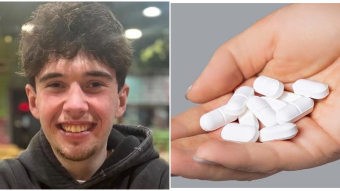 paracetamol overdose