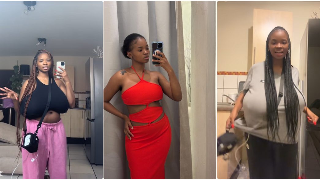 Michelle Sekwena shares her struggle with gigantomastia