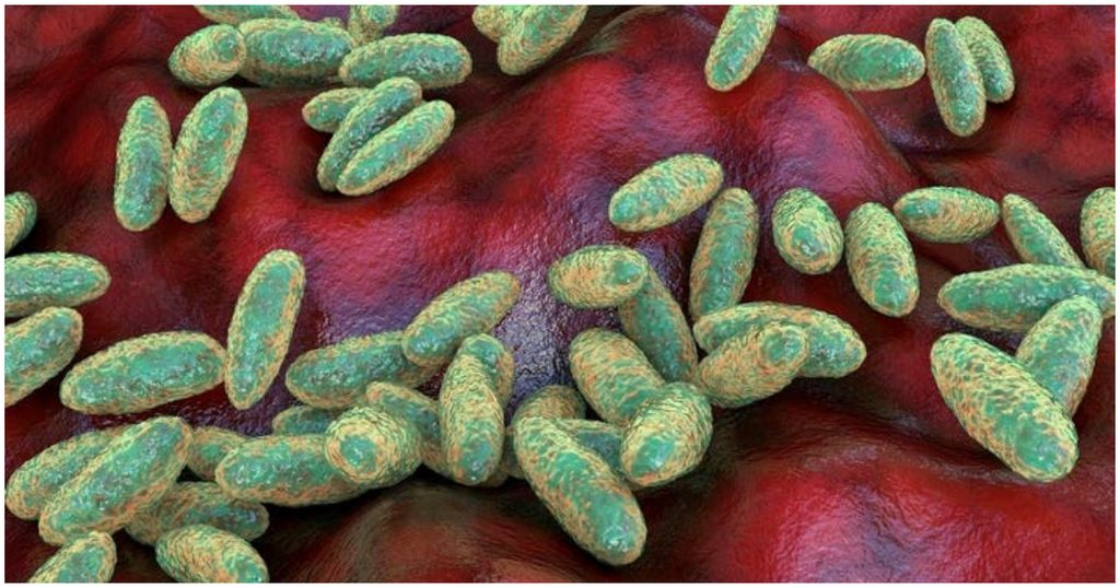 pneumonic plague