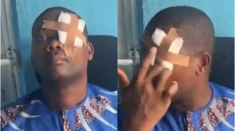 Landlord Allegedly Punched in the Eye by Tenant After Serving Rent Increase Notice
