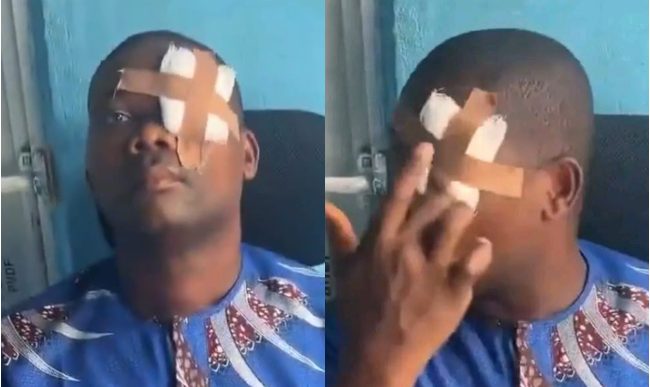 Landlord Allegedly Punched in the Eye by Tenant After Serving Rent Increase Notice