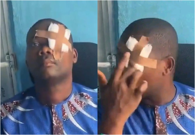 Landlord Allegedly Punched in the Eye by Tenant After Serving Rent Increase Notice